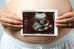 Pregnant woman showing ultrasound image